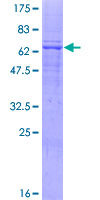 AGPAT4 Protein - 12.5% SDS-PAGE of human AGPAT4 stained with Coomassie Blue