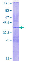 AGPAT4 Protein - 12.5% SDS-PAGE Stained with Coomassie Blue.