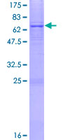AGPAT5 Protein - 12.5% SDS-PAGE of human AGPAT5 stained with Coomassie Blue