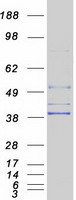 AGPAT5 Protein - Purified recombinant protein AGPAT5 was analyzed by SDS-PAGE gel and Coomassie Blue Staining