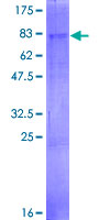 AGPAT6 Protein - 12.5% SDS-PAGE of human AGPAT6 stained with Coomassie Blue