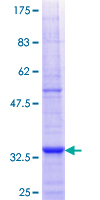 AGPAT6 Protein - 12.5% SDS-PAGE Stained with Coomassie Blue.