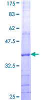AGPS Protein - 12.5% SDS-PAGE Stained with Coomassie Blue.