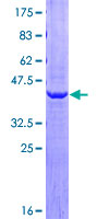AGR2 Protein - 12.5% SDS-PAGE of human AGR2 stained with Coomassie Blue