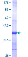 AGR2 Protein - 12.5% SDS-PAGE Stained with Coomassie Blue.