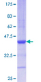 AGR2 Protein - 12.5% SDS-PAGE Stained with Coomassie Blue.
