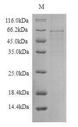 AGT / Angiotensinogen Protein - (Tris-Glycine gel) Discontinuous SDS-PAGE (reduced) with 5% enrichment gel and 15% separation gel.