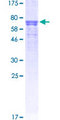 AGT / Angiotensinogen Protein - 12.5% SDS-PAGE of human AGT stained with Coomassie Blue
