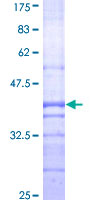 AGT / Angiotensinogen Protein - 12.5% SDS-PAGE Stained with Coomassie Blue.