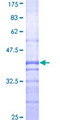AGT / Angiotensinogen Protein - 12.5% SDS-PAGE Stained with Coomassie Blue.