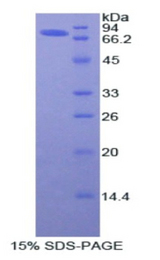 AGT / Angiotensinogen Protein - Recombinant Angiotensinogen By SDS-PAGE