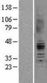 AGTR2 / AT2 Receptor Protein - Western validation with an anti-DDK antibody * L: Control HEK293 lysate R: Over-expression lysate
