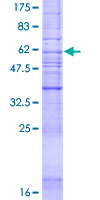 AGTR2 / AT2 Receptor Protein - 12.5% SDS-PAGE of human AGTR2 stained with Coomassie Blue