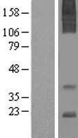 AGTRAP / ATRAP Protein - Western validation with an anti-DDK antibody * L: Control HEK293 lysate R: Over-expression lysate