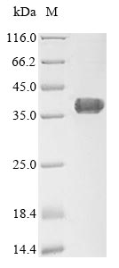 AGTRAP / ATRAP Protein - (Tris-Glycine gel) Discontinuous SDS-PAGE (reduced) with 5% enrichment gel and 15% separation gel.