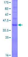 AGTRAP / ATRAP Protein - 12.5% SDS-PAGE of human AGTRAP stained with Coomassie Blue