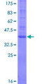 AGTRAP / ATRAP Protein - 12.5% SDS-PAGE of human AGTRAP stained with Coomassie Blue