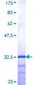 AGTRAP / ATRAP Protein - 12.5% SDS-PAGE Stained with Coomassie Blue.