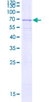 AGXT / SPT Protein - 12.5% SDS-PAGE of human AGXT stained with Coomassie Blue