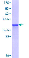 AGXT / SPT Protein - 12.5% SDS-PAGE Stained with Coomassie Blue.
