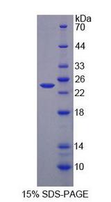 AGXT / SPT Protein - Recombinant Alanine Glyoxylate Aminotransferase (AGXT) by SDS-PAGE