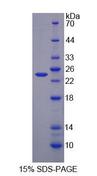 AGXT / SPT Protein - Recombinant Alanine Glyoxylate Aminotransferase (AGXT) by SDS-PAGE