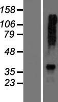 AGXT2 Protein - Western validation with an anti-DDK antibody * L: Control HEK293 lysate R: Over-expression lysate
