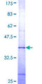 AGXT2 Protein - 12.5% SDS-PAGE Stained with Coomassie Blue.