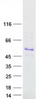 AGXT2 Protein - Purified recombinant protein AGXT2 was analyzed by SDS-PAGE gel and Coomassie Blue Staining
