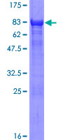 AHCYL1 / DCAL Protein - 12.5% SDS-PAGE of human AHCYL1 stained with Coomassie Blue