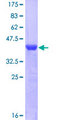 AHCYL1 / DCAL Protein - 12.5% SDS-PAGE Stained with Coomassie Blue.