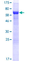 AHDC1 Protein - 12.5% SDS-PAGE of human AHDC1 stained with Coomassie Blue