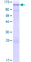 AHI1 Protein - 12.5% SDS-PAGE of human AHI1 stained with Coomassie Blue