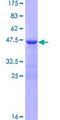 AHNAK Protein - 12.5% SDS-PAGE of human AHNAK stained with Coomassie Blue