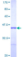 AHNAK Protein - 12.5% SDS-PAGE Stained with Coomassie Blue.