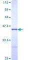 AHNAK Protein - 12.5% SDS-PAGE Stained with Coomassie Blue.