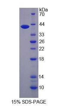 AHNAK Protein - Recombinant  Desmoyokin By SDS-PAGE
