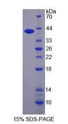 AHNAK Protein - Recombinant  Desmoyokin By SDS-PAGE
