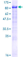 AHNAK2 Protein - 12.5% SDS-PAGE of human AHNAK2 stained with Coomassie Blue