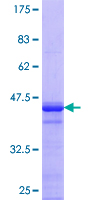 AHNAK2 Protein - 12.5% SDS-PAGE Stained with Coomassie Blue.