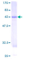 AHSA1 / AHA1 Protein - 12.5% SDS-PAGE of human AHSA1 stained with Coomassie Blue
