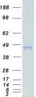AHSA1 / AHA1 Protein - Purified recombinant protein AHSA1 was analyzed by SDS-PAGE gel and Coomassie Blue Staining