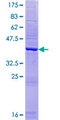 AHSA2 Protein - 12.5% SDS-PAGE of human AHSA2 stained with Coomassie Blue