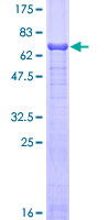 AHSG / Fetuin A Protein - 12.5% SDS-PAGE of human AHSG stained with Coomassie Blue