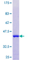 AHSP / EDRF Protein - 12.5% SDS-PAGE of human ERAF stained with Coomassie Blue