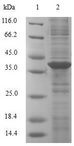 AHSP / EDRF Protein - (Tris-Glycine gel) Discontinuous SDS-PAGE (reduced) with 5% enrichment gel and 15% separation gel.