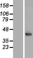 AIDA Protein - Western validation with an anti-DDK antibody * L: Control HEK293 lysate R: Over-expression lysate