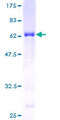 AIDA Protein - 12.5% SDS-PAGE of human FLJ12806 stained with Coomassie Blue