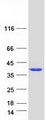 AIDA Protein - Purified recombinant protein AIDA was analyzed by SDS-PAGE gel and Coomassie Blue Staining