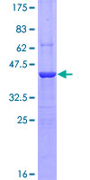 AIF1 / IBA1 Protein - 12.5% SDS-PAGE of human AIF1 stained with Coomassie Blue